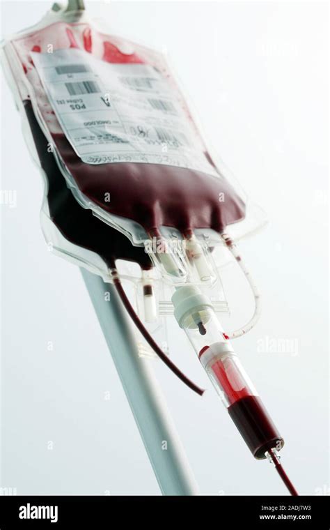 fake blood transfusion bag|blood transfusion machine called.